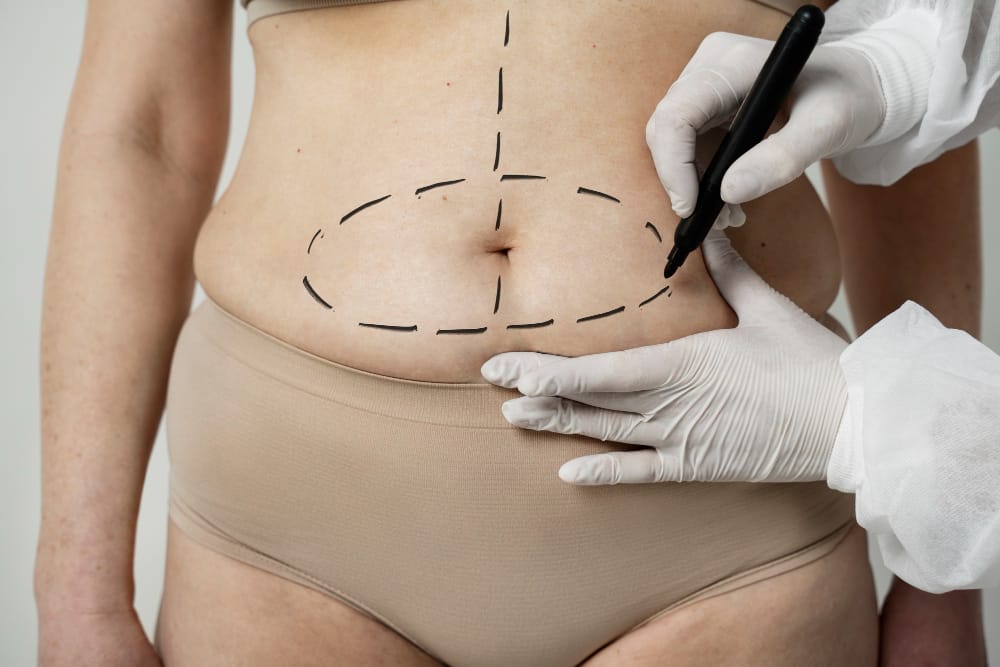 Qual o momento certo de realizar a cirurgia plástica pós-parto?